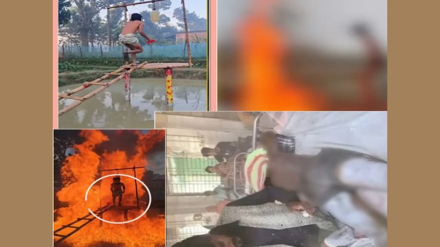 হাস্যরস নয়, ভয়াবহ ট্র্যাজেডি: পেট্রল দিয়ে কনটেন্ট বানাতে গিয়ে দগ্ধ কনটেন্ট ক্রিয়েটর আল-আমিন